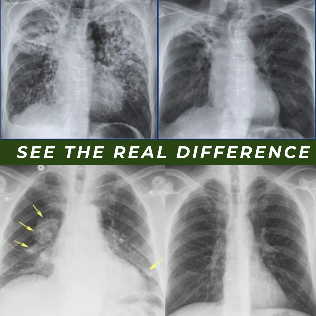 Relax Your Chest, Not Just Your Mind